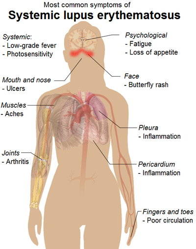 Cureus  Facial Presentation of Crohn's Disease: Report of a Case